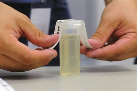 how to store urine for drug tests